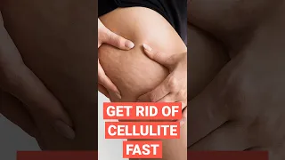 Get Rid of Cellulite Fast #shorts #short #shortvideo