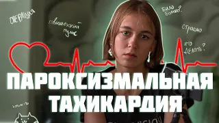 пароксизмальная тахикардия | синдром wpw | операция