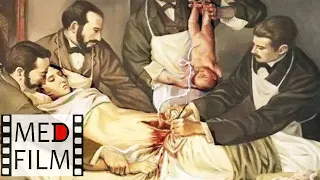 Кесарево - традиционная операция, академик А.Н.Стрижаков © Traditional caesarean section