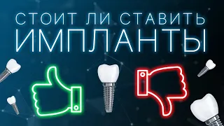 Стоит ли ставить зубные импланты.