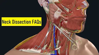 Neck Dissection Surgical Anatomy: OR FAQs & Answers [201]