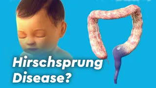 Hirschsprung Disease, Colitis, and Fecal Incontinence