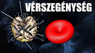 Vérszegénység - ezt tudnod kell róla, akkor is ha nem érint