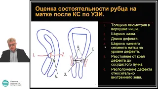 Несостоятельность рубца на матке после кесарева сечения  Критерии диагноза