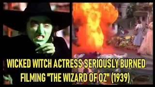 Wicked Witch Actress Seriously Burned Filming "Wizard Of Oz" (1939)