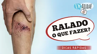 RALADO: O QUE FAZER? E O QUE NÃO FAZER?