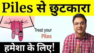 10 Tips To Get Rid Of Piles | Piles Treatment At Home | पाइल्स का इलाज | by Dr. Saleem Zaidi