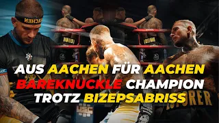 Aus Aachen für Aachen- Bareknuckle Champion trotz Bizepsabriss 😱