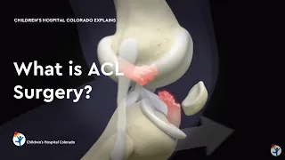 What is ACL Surgery?