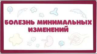 Болезнь Минимальных Изменений (нефротический синдром) лекция