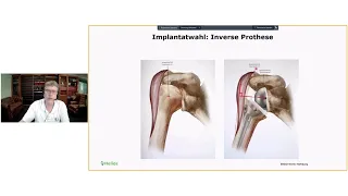 Vortrag: „Das künstliche Schultergelenk“ - Dr. Jörg Neumann, Leitender Arzt Gelenkchirurgie