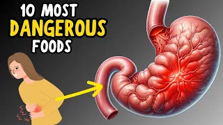 10 Most Dangerous Foods That People Keep Eating Every Day | Health Hub