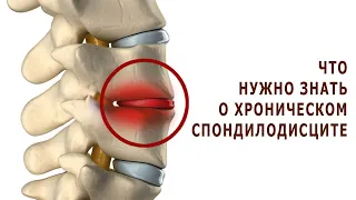 Что нужно знать о хроническом спондилодисците