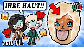 😱 GEBOREN MIT EINER HAUTKRANKHEIT 😱 TEIL 1 💋 DIE HAUTKRANKHEIT DEUTSCHE TOCA BOCA