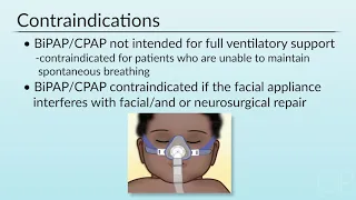 Non-Invasive Ventilation in the Non-ICU Setting by J. Gemignani, J. Rettig | OPENPediatrics