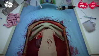 Surgeon Simulator PS4 Space Double Kidney Transplant A++