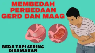 Perbedaan GERD dan Maag yang Sering Disamakan