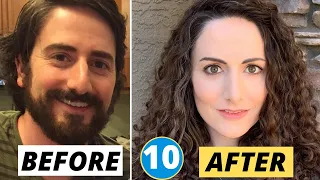 10 Sex Reassignment Surgeries (Male to Female)