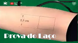 Prova do Laço como fazer e como interpretar