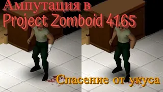 Ампутация и протезы в Project Zomboid Обзор мода