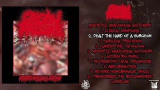 Organ Failure - Assisted Anatomical Butchery FULL EP (2024 - Goregrind)