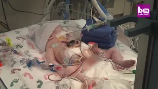 Baby born with heart outside her chest