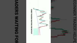 TRADING MAIN TRAP SE ESE LOSS HOTA HAI #tradingview | Stock | Market | crypto | Trading | #short