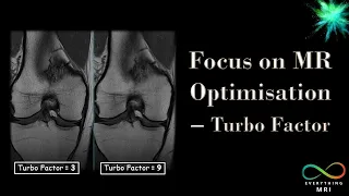 Focus on MR Optimisation - Turbo Factor