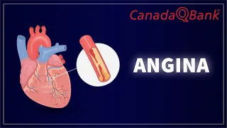 Angina