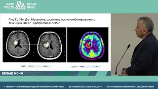 Облучение всего головного мозга на современном этапе при метастатическом поражении (Банов С.М.)