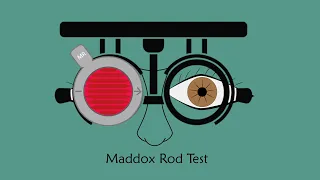 Maddox Rod Test