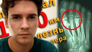 Пробежал 1000 км с больной ногой. Диагноз - болезнь Келлера. Марафон вокруг света.