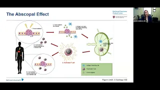 Webinar: Novel treatment approaches for intrahepatic cholangiocarcinoma