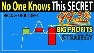 🔴 The Only "HEAD & SHOULDERS" Trading Strategy You Will Ever Need (5 Easy Steps To BIG PROFITS)