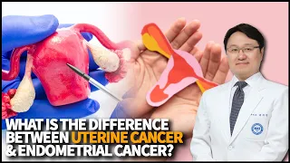 What is the difference between Uterine Cancer and Endometrial Cancer? What is its survival rate?