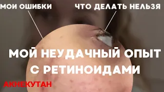 АКНЕКУТАН | НЕУДАЧНЫЙ ОПЫТ | Моя история приема ретиноидов. Побочные эффекты ретинола.