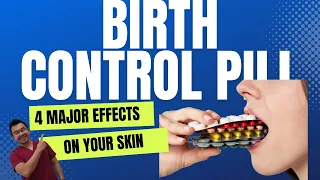 4 MAJOR Effects of Birth Contrl Pills On Your Skin