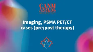 Imaging, PSMA PET/CT cases (pre/post therapy)