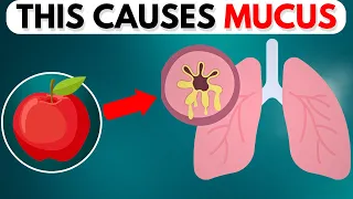 Top 11 Mucus Trigger Foods to Avoid