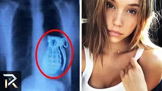 BIZARRE Things Discovered Inside People After X-Rays