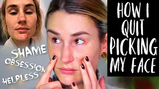 HOW I STOPPED PICKING MY FACE: From Self Abuse To Self Love