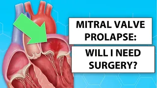 Mitral Valve Prolapse: Will I Need Heart Surgery?
