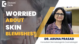 Best Remedies For Blemishes On Face #darkspots #beauty    - Dr. Aruna Prasad | Doctors' Circle