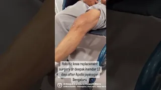 Painless robotic knee replacement surgery dr Deepak Inamdar jayanagar Bengaluru