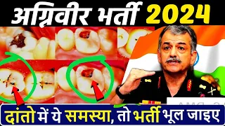 दांतो में ये समस्या है तो अग्निवीर भर्ती नहीं होगी ? Agneepath teeth medical test | Agniveer Medical