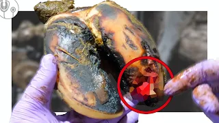 DECAYING BONE in COW'S FOOT .... no wonder she's sore