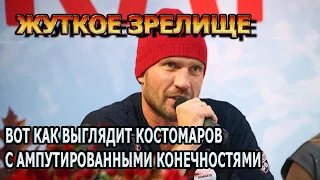 ПОБЛЕДНЕЕТЕ ОТ УВИДЕННОГО! Роман Костомаров впервые показал себя без конечностей