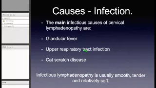 Cervical Lymphadenopathy