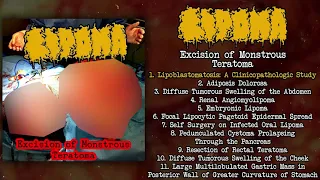 Lipoma - Excision of Monstrous Teratoma FULL EP (2021 - Pathological Goregrind)