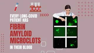 Long Covid Research: Microclots